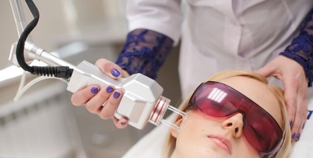 The principle of face renewal with laser