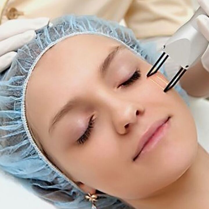 Laser fractionated rejuvenation